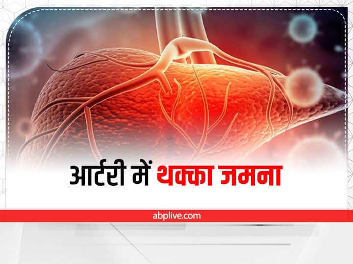 blood clotting blood vessel blood cells thrombosis Blood Clotting: जानलेवा होता है आर्टरी और वेन में थक्का जमना, ये हैं थ्रोम्बोम्बोलिज़म के लक्षण