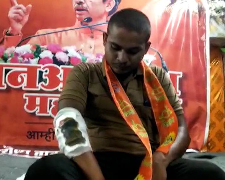 Jalgaon News Despite being injured in the accident, Deepak Patil, shivsainik attended the Shiv Sena rally in Parola Jalgaon News : पारोळ्याच्या मेळाव्यात भेटला असाही शिवसैनिक...