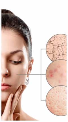 Multani Mitti for Skin : गुलाबी और निखरी स्किन के लिए चेहरे पर लगाएं मुल्तानी मिट्टी, होंगे कई फायदे