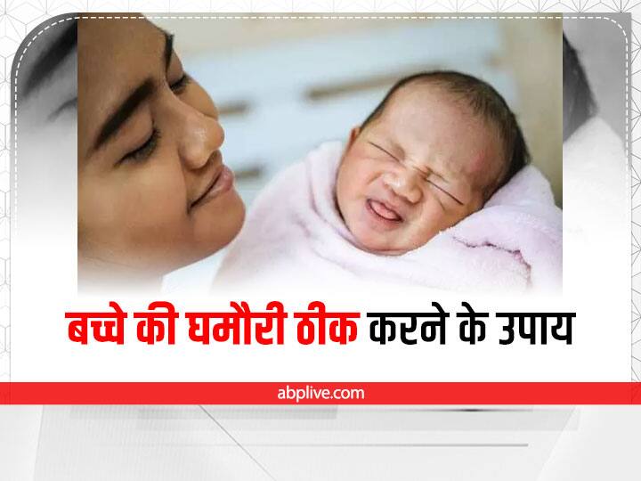 Prickly Heat Problem In Babies Home Remedy For Baby Rashes Parenting Tips: जानिए बच्चे को क्यों हो रही हैं घमौरियां, कैसे ठीक करें इसे