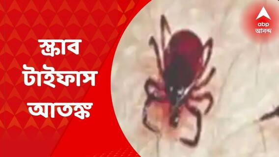 Kolkata: কলকাতায় ফিরল স্ক্রাব টাইফাসের আতঙ্ক, বাড়ছে আক্রান্ত। Bangla ‌News