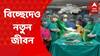 Kolkata Critical Surgery : 'জুড়ে থাকা লিভারের অংশ কেটে পৃথক যমজ শিশুকে', NRS-এ বিরল অস্ত্রোপচার