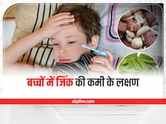 Parenting Tips: कमजोर होता जा रहा है बच्चा, हो सकती है जिंक की कमी, इन लक्षणों से पहचानें