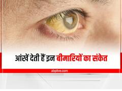 Health Tips : इन गंभीर बीमारियों की ओर इशारा देती हैं आंखें, ऐसे करें पहचान 