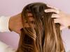 Hair Fall: జుట్టు రాలిపోతుందా? ఈజీగా ఇంట్లో తయారు చేసుకునే ఈ నూనెతో మీ జుట్టుని కాపాడుకోవచ్చు