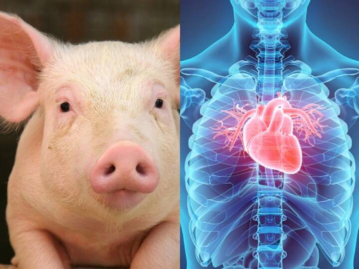 New York University Surgeons have transplanted genetically-engineered pig hearts into two brain-dead people Pig Heart Transplant: दो ब्रेन-डेड इंसानों के शरीर में लगाया गया सूअर का दिल, डॉक्टरों ने बताया कैसे काम कर रहा हार्ट