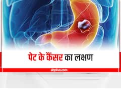 Stomach Cancer : पेट में दिखने वाले इन लक्षणों को न करें नजरअंदाज, वरना सेहत पर पड़ सकता है बुरा असर