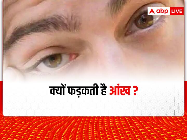 क्यों फड़कती है आंख, क्या ये किसी बीमारी का लक्षण है? KhabarKeeda
