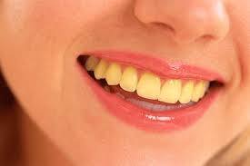 Dental Care: Troubled by yellowing of teeth ..? This homemade gel will solve your problem Dental Care : ਦੰਦਾਂ ਦੇ ਪੀਲੇ ਹੋਣ ਤੋਂ ਹੋ ਪਰੇਸ਼ਾਨ..? ਇਹ ਘਰੇਲੂ ਜੈੱਲ ਤੁਹਾਡੀ ਸਮੱਸਿਆ ਦਾ ਕਰਨਗੇ ਹੱਲ 