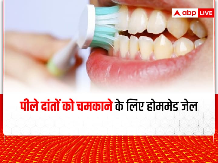 Home Made Toothpaste With Aloe Vera Gel Brush Your Teeth With Aloe Vera Best Homemade Tooth Gel Dental Care: दांतो के पीलेपन से हैं परेशान..? ये होममेड जेल करेगा, आपकी समस्या का समाधान