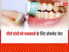 Dental Care: दांतो के पीलेपन से हैं परेशान..? ये होममेड जेल करेगा, आपकी समस्या का समाधान