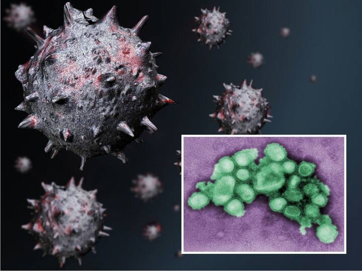 Influenza A virus does not affect the severity of SARS-CoV-2 infection: Study Influenza Vs Covid 19: ఇన్‌ఫ్లూయెంజా A వైరస్, కోవిడ్-19 ఒకేసారి సోకితే వ్యాధి తీవ్రమవుతుందా? స్టడీలో తేలింది ఇదే!