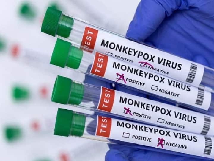 Noida Monkeypox Case Health department said A suspected case of monkeypox reported in Uttar Pradesh Noida Monkeypox Case Noida: नोएडा में मिला मंकीपॉक्स का संदिग्ध मरीज, 47 साल की महिला का सैंपल जांच के लिए भेजा गया
