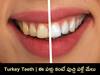 Turkey Teeth: ‘టర్కీ’ దంతాలంటే ఏమిటీ? డెంటిస్టులు ఎందుకు సీరియస్ అవుతున్నారు?
