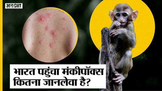 Monkeypox Virus: India में आया मंकीपॉक्स वायरस का पहला मामला, कितना ख़तरनाक है इससे होने वाली बीमारी