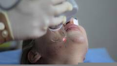 Health Tips: বর্ষায় ব্রণর হামলা আটকাতে এই নিয়মগুলি মানলে মিলবে উপকার