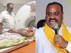 TDP Leader Attack: టీడీపీ నేతపై హత్యాయత్నం, గొడ్డళ్లతో దాడి చేసిన ప్రత్యర్థులు - సీఎం జగన్‌పై అచ్చెన్నాయుడు ఫైర్