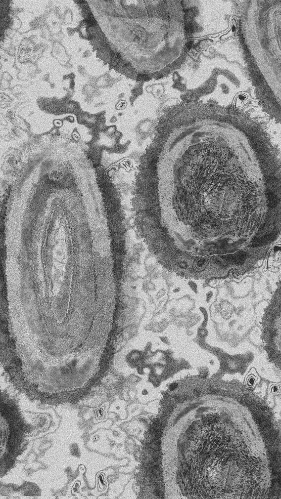 মাঙ্কি পক্স আটকানোর কয়েকটি উপায়, দেখুন ছবি