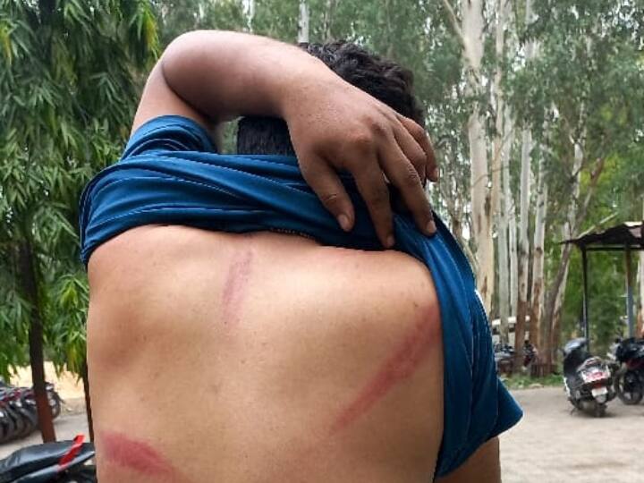 MP News MLA son with colleagues allegedly beat up forest workers and then fired in Singrauli ANN Singrauli Crime News: बीजेपी विधायक के बेटे पर वनकर्मियों को पीटने और गोली मारने का आरोप, कोयले से भरा ट्रक रोकने पर हुई वारदात