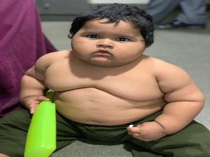 Mumbai News second youngest boy undergo bariatric surgery a rare disorder know complete details marathi news Mumbai : भारतातील दुसऱ्या सर्वात लहान मुलावर दुर्मिळ विकारामुळे 'बॅरिएट्रिक शस्त्रक्रिया'; काय आहे हा विकार? जाणून घ्या