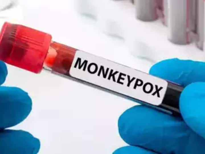 monkeypox Know the travel history of Its patients in India, third case found in kerala Monkeypox Cases: कोरोना के बाद टेंशन में डालने लगा है मंकीपॉक्स! भारत में अब तक मिले 3 मरीजों की इन देशों से जुड़ी है ट्रैवल हिस्ट्री