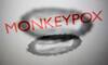 Monkeypox  : मंकीपॉक्स सार्वजनिक आरोग्य आणीबाणी  म्हणून घोषित, डब्ल्यूएचओकडून  मंकीपॉक्सबद्दल चिंता व्यक्त