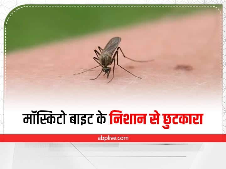 Mosquito Bite: मच्छर के काटने से चेहरे पर आए दाग कुछ ही दिन में हो जाएंगे गायब, बस लगानी होंगी ये चीजें Mosquito bite home remedies to get rid from marks due to mosquito bite Mosquito Bite: मच्छर के काटने से चेहरे पर आए दाग कुछ ही दिन में हो जाएंगे गायब, बस लगानी होंगी ये चीजें