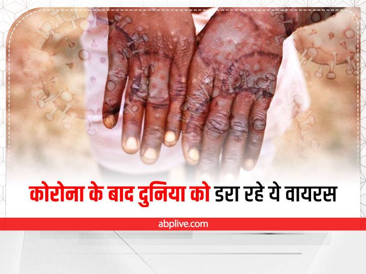 Monkeypox to Marburg virus dangerous viruses scaring world after corona pandemic Explained Explained: मंकीपॉक्स से मारबर्ग तक... कोरोना महामारी के बाद दुनिया को डरा रहे ये खतरनाक वायरस