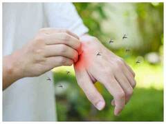 Health Care : मच्छरों के डंक से करना है बचाव, अपनाएं ये घरेलू नुस्खे