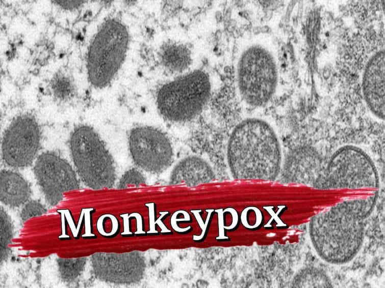 Monkeypox Delhi Experts Say No Need to Panic Know Monkeypox Virus Symptoms How Infection Spread Monkeypox Delhi: एक्सपर्ट्स बोले- घबराने की जरूरत नहीं, जानें- क्या हैं इसके लक्षण और कैसे फैलता है संक्रमण