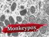 गाजियाबाद में Monkeypox का खतरा दे रहा है दस्तक! जिले में मिले 2 संदिग्ध, एक का दिल्ली में चल रहा इलाज