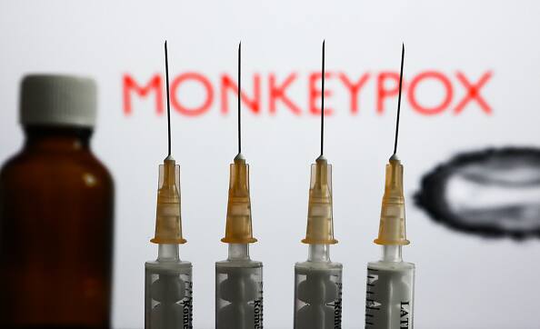 Monkeypox spreading rapidly Measures Should Be Devoid Of Stigma WHO Chalks Out Monkeypox Strategy Monkeypox | 'Measures Should Be Devoid Of Stigma': WHO Asks Nation To Strengthen Surveillance