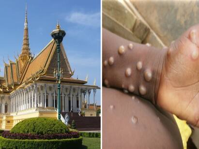 Monkeypox patient who flee from Thailand found in Cambodian capital Monkey Pox : சுற்றுலா வந்த இடத்தில் குரங்கம்மை பாதிப்பு..! தாய்லாந்தில் இருந்து கம்போடியா தப்பியோடிய நைஜீரிய வாலிபர்..!
