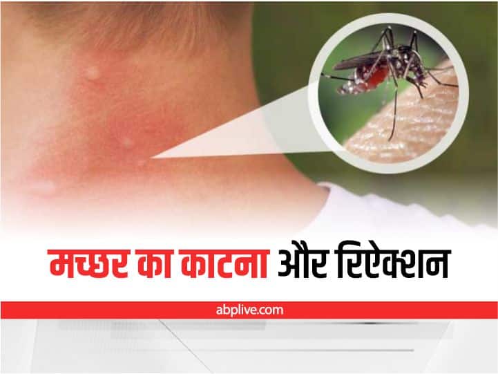diy herbal tips to use as Mosquito Repellent in daily life Mosquito Repellent: मच्छर भगाने के हर्बल उपाय, लंग्स को नहीं होगा नुकसान