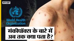 Monkeypox : India में 4 cases, WHO ने बताया World Health Emergency, Symptoms-Test-Vaccines क्या हैं?