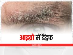 Eyebrow Dandruff: सिर्फ बालों में ही नहीं आइब्रो में भी होती है डैंड्रफ, ऐसे पाएं छुटकारा