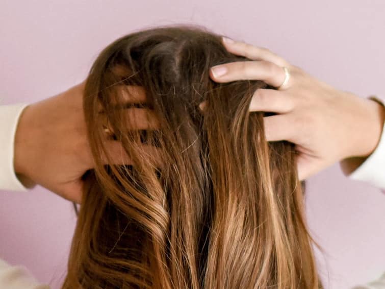 How To Treat Dry Scalp Home Remedies For Dry Scalp Dandruff And Itch Scalp