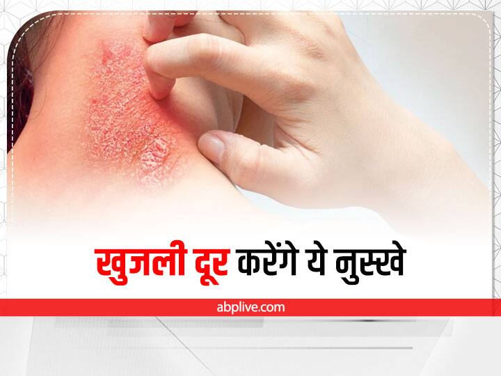 Itching Home Remedies: You will get relief from itching in monsoon season, try these home remedies Itching Home Remedies: मानसून सीजन में होने वाली खुजली से मिलेगी राहत, इन घरेलू उपायों को आज़माएं