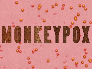 Monkeypox : सावधान...भारतातही मंकीपॉक्सचा पहिला संशयित रुग्ण समोर? 'ही' लक्षणं तुम्हाला नाही ना? वेळीच जाणून घ्या..