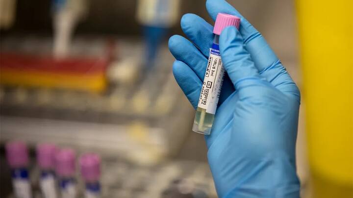 ਭਾਰਤ ਵਿੱਚ ਹੁਣ ਤਕ ਮੰਕੀਪੌਕਸ ਦੇ ਚਾਰ ਮਾਮਲੇ ਸਾਹਮਣੇ ਆ ਚੁੱਕੇ ਹਨ, ਪਰ ਇਸ ਬਿਮਾਰੀ ਤੋਂ ਘਬਰਾਉਣ ਲਈ ਚੌਕਸ ਰਹਿਣ ਦੀ ਲੋੜ ਹੈ।