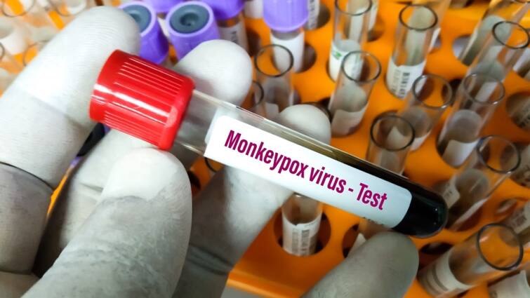 one youth dies with monkeypox like symptoms in kerala health dept initiates inquiry  Monkeypox Suspected Dies: કેરળમાં મંકીપોક્સના લક્ષણો ધરાવતા UAEથી પરત ફરેલા દર્દીનું મોત, તપાસના આદેશ