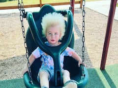 Hair Syndrome: ఈ పాపని చూస్తుంటే ఐన్‌స్టీన్ మళ్లీ పుట్టినట్టు అనిపిస్తోందా? నిజానికి ఈ పాపదో అరుదైన వ్యాధి