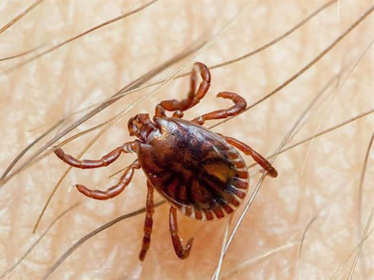 Explained Crimean-Congo Haemorrhagic Virus Fever Causes Symptoms Prevention of Tick-Borne Viral Disease In Spain Explained: What Is Crimean-Congo Haemorrhagic Fever? All About The Tick-Borne Viral Disease Reported In Spain