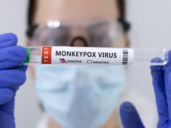 ICMR isolated monkeypox virus from sample which help in making Indian vaccine ANN ICMR ने नमूने से मंकीपॉक्स वायरस को किया अलग, भारतीय वैक्सीन बनाने में मिलेगी मदद