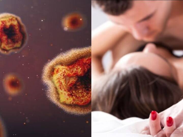 World health organization chief advises reducing sex partners to avoid monkeypox Monkeypox:அதிக நபர்களுடன் பாலுறவைத் தவிருங்கள்... உடலுறவின் மூலம் குரங்கம்மை பரவலாம்...மருத்துவர்கள் எச்சரிக்கை!