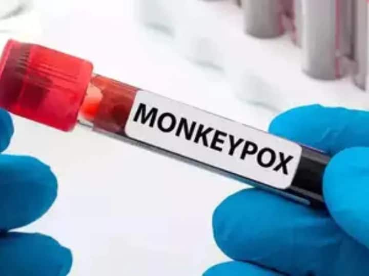 Rajasthan News First suspected patient of monkeypox found in Rajasthan Monkeypox in Rajasthan: मंकीपॉक्स का राजस्थान में मिला पहला संदिग्ध मरीज, स्पेशल वार्ड में भर्ती