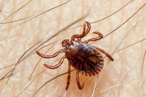 Congo Fever crimean congo hemorrhagic virus fever causes symptoms prevention of tick borne viral disease in spain Congo Fever : आता काँगो तापाचा धोका; जगभरात चिंतेचं वातावरण, जाणून घ्या या आजाराची लक्षणं