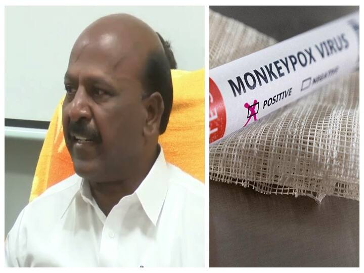 Kanyakumari Monkey pox symptoms 4 people Admitted in hospital Monkeypox Cases: கன்னியாகுமரியில் 4 பேருக்கு குரங்கு அம்மை அறிகுறி: அமைச்சர் மா.சுப்பிரமணியன் விளக்கம்