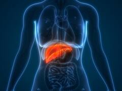 Noida News: नोएडा में रोजाना मिल रहे हैं हेपेटाइटिस के 400 संदिग्ध मरीज, सामने आई ये बड़ी वजह