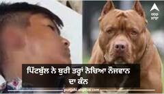 ਪਿੱਟਬੁੱਲ ਨੇ ਬੁਰੀ ਤਰ੍ਹਾਂ ਨੋਚਿਆ ਨੌਜਵਾਨ ਦਾ ਕੰਨ, ਪਿਤਾ ਨੇ ਮੁਸ਼ਕਲ ਨਾਲ ਬਚਾਈ ਜਾਨ